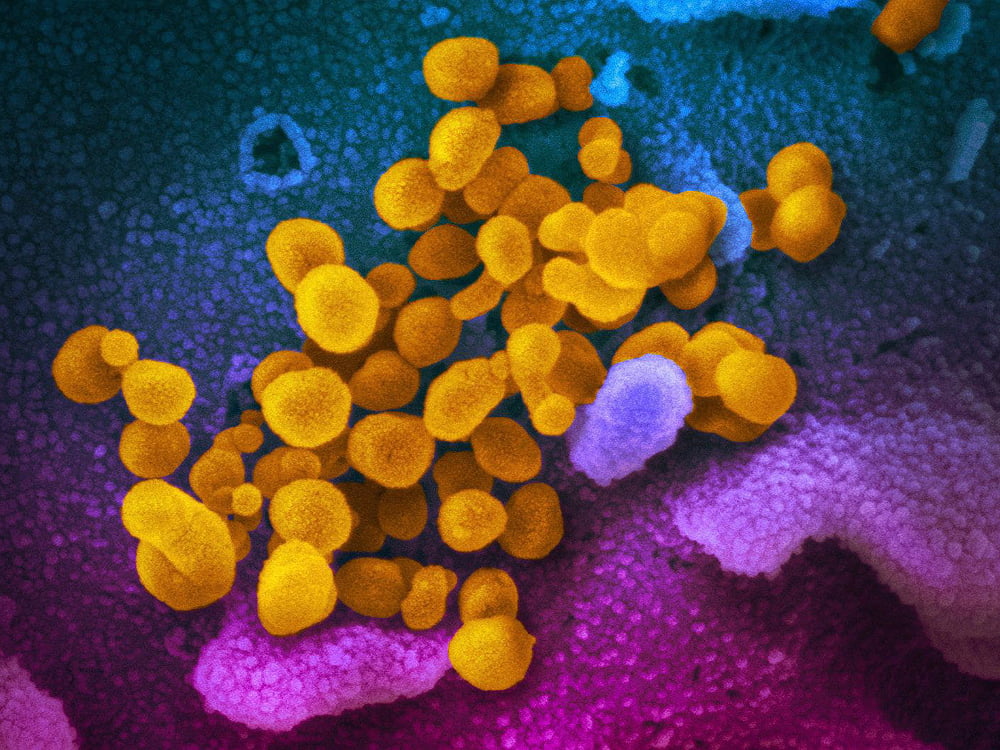 coronavirus3