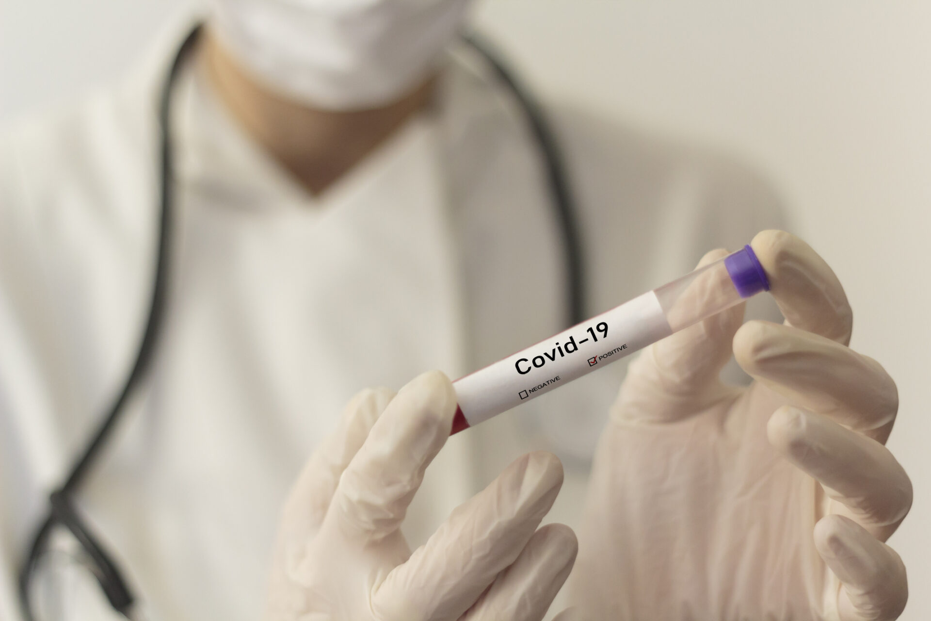 coronavirus vial