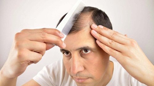 Try this natural method at home from today! The problem of hair loss will be removed overnight