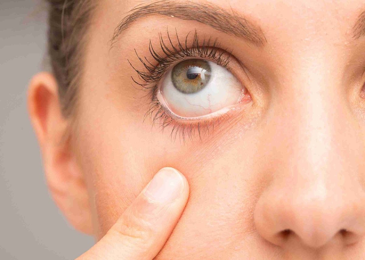 EYE DRYNESS Vitamin B12