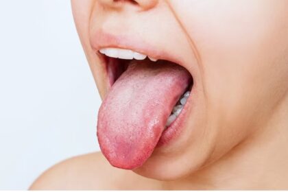 tongue 2