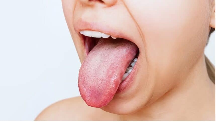 tongue 2