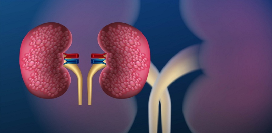 kidney