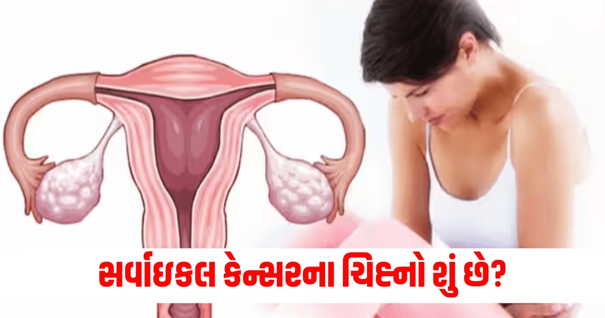 how to identify cervical cancer signs and symptoms of this disease